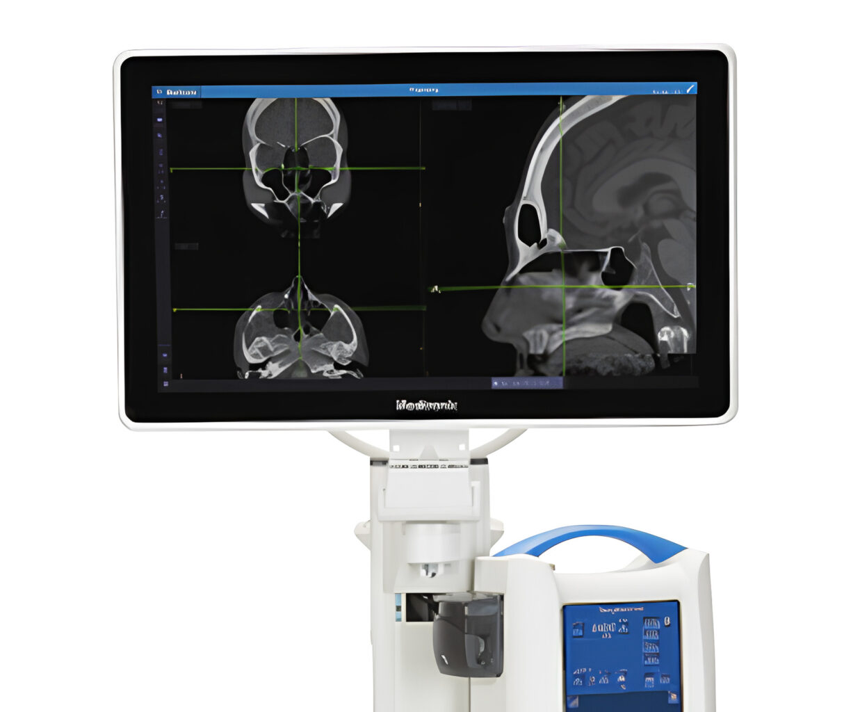 3D 네비게이션(Medtronic FlexENT™)