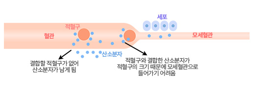 우리가 생활하는 기압 환경