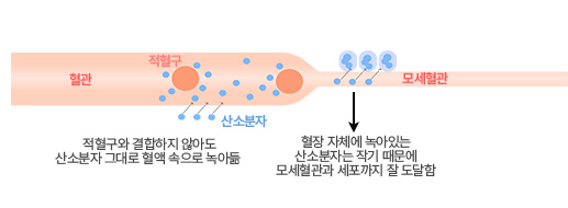 산소 챔버 고기압 환경